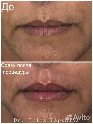 Врач косметолог Врач косметолог