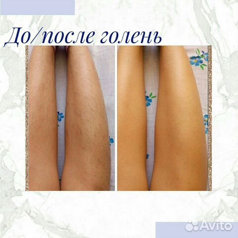 Депиляция воском
